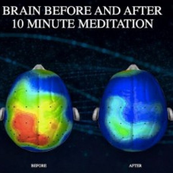 How Meditation May Change the Brain - The New York Times