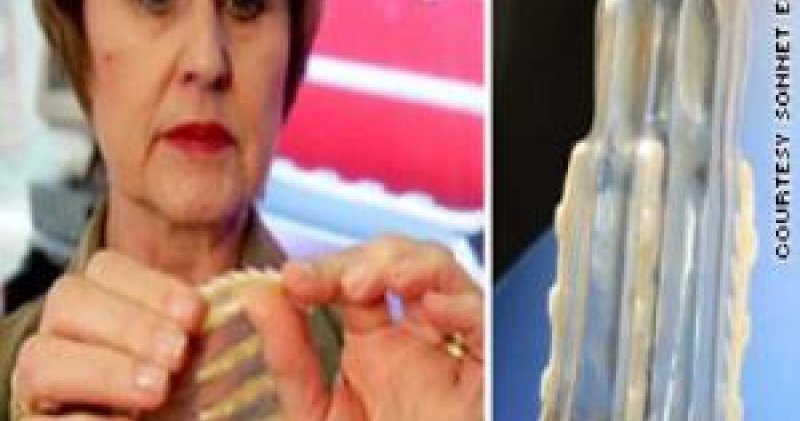 South African doctor invents female condoms with 'teeth' to fight rape |  SikhNet